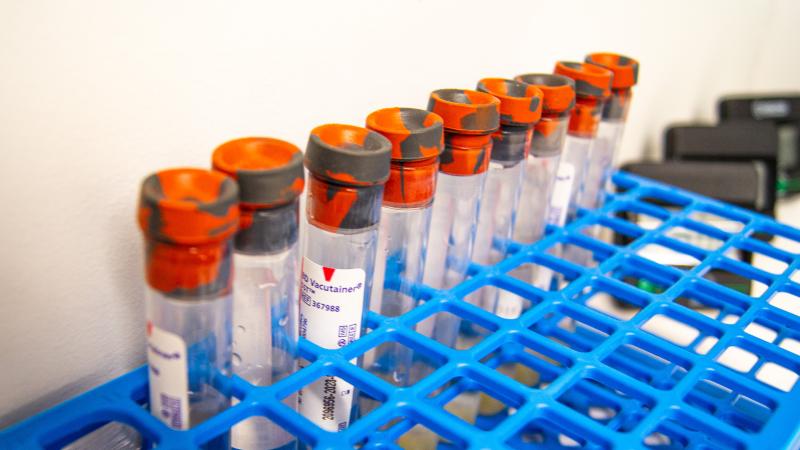 Test tubes sitting in a tray. 